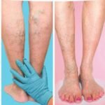 Life without Product Design